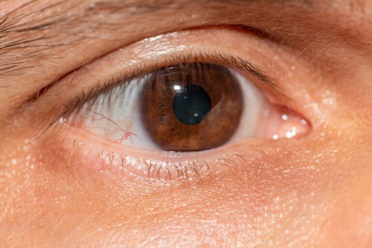 Glaucoma Specialist in Indirapuram