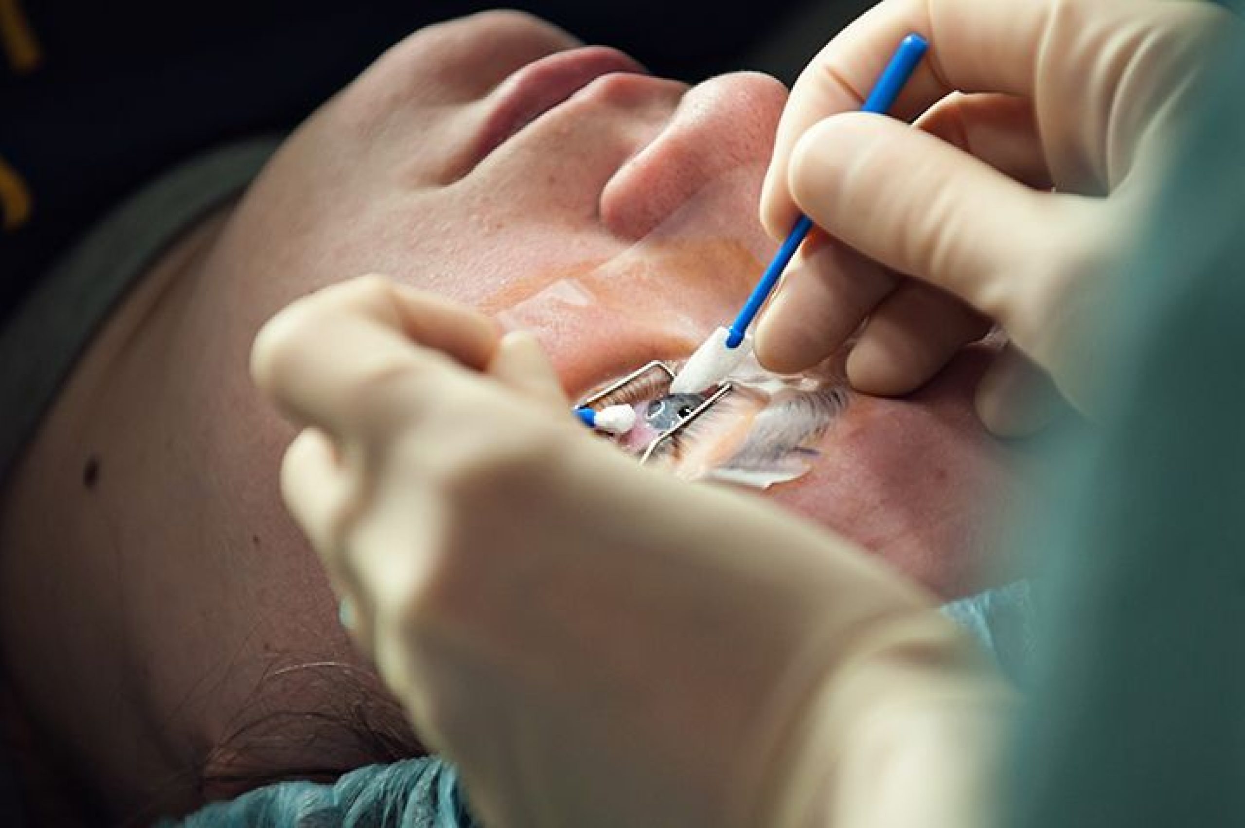 Best Opthamologist in indirapuram